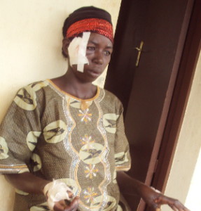 Vénantie Ntakirutimana est en train de recevoir des soins intensifs ©Iwacu