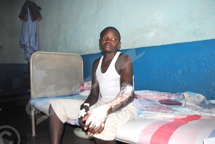 Mercredi, 28 mai 2014 – Ce jeune de 16 ans a été brûlé par son patron, l'accusant de laisser voler son vélo. Il est alité au centre de santé La Sagesse à Bwiza. ©J.E.V/Iwacu