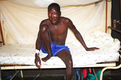 L’inconnu blessé à Ngagara et admis à l’Hôpital Militaire ©Iwacu