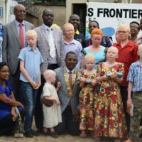 A genoux au milieu, le gouverneur de district entouré d’albinos et membres de Rotary Club Bujumbura-Ingoma