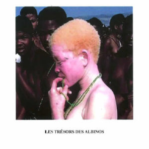 Daniel Kabuto, Les trésors des albinos