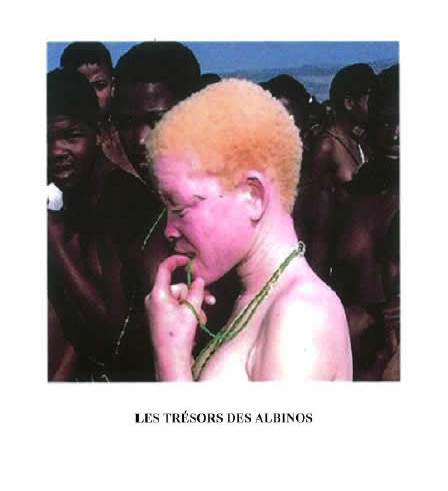 Daniel Kabuto, Les trésors des albinos