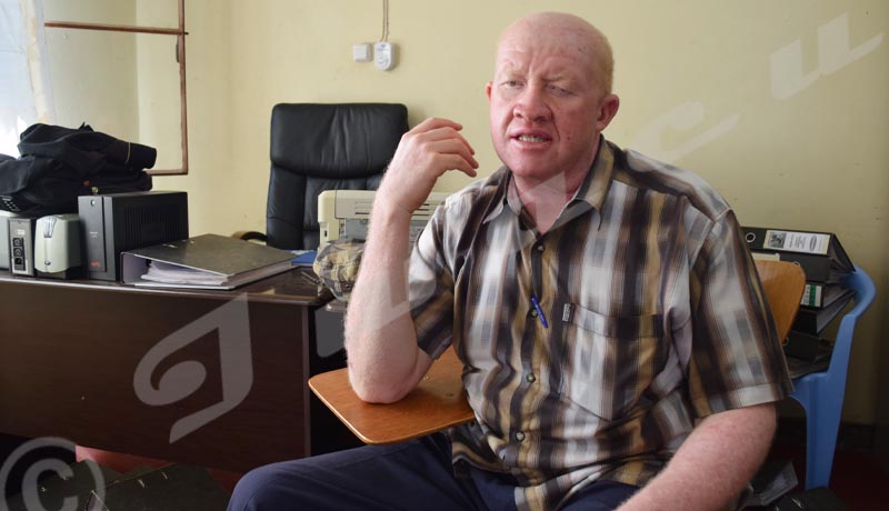 Kassim Kazungu, Chairman of the local association defending Albinos’ rights-“Albinos sans Frontières” 