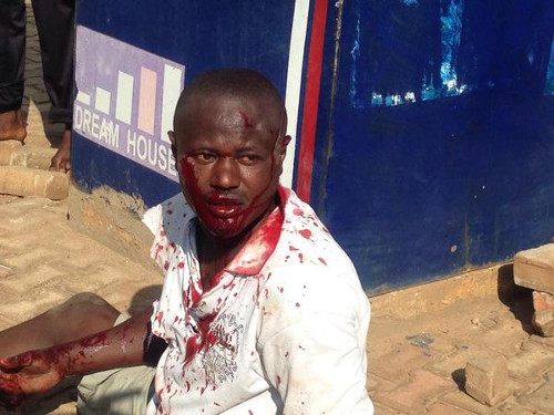 L'homme qui a lancé une grenade Boulevard de l'Uprona, juste avant d’être évacué par la police  ©Teddy Mazina 