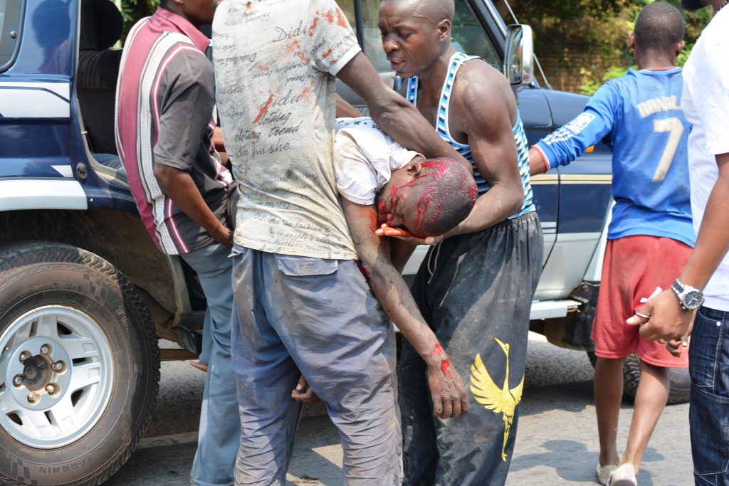 Un des blessés évacués vers le Centre de santé Carolus Magnus de Kajaga