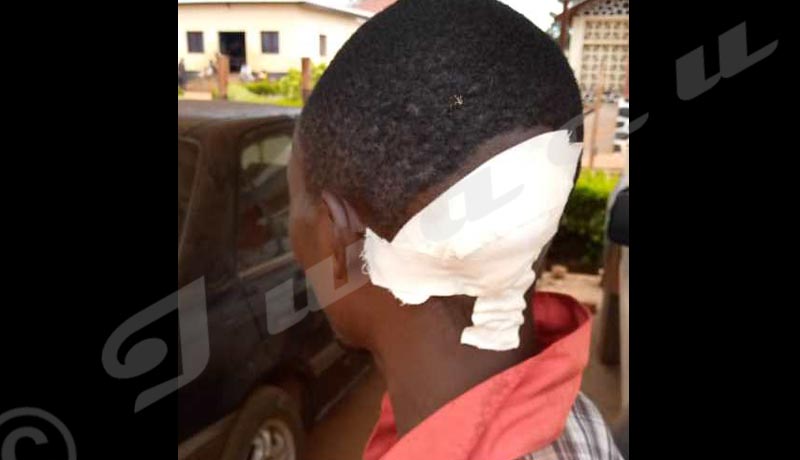Muyinga/Rugari : Qui a attaqué les militants du CNL ?