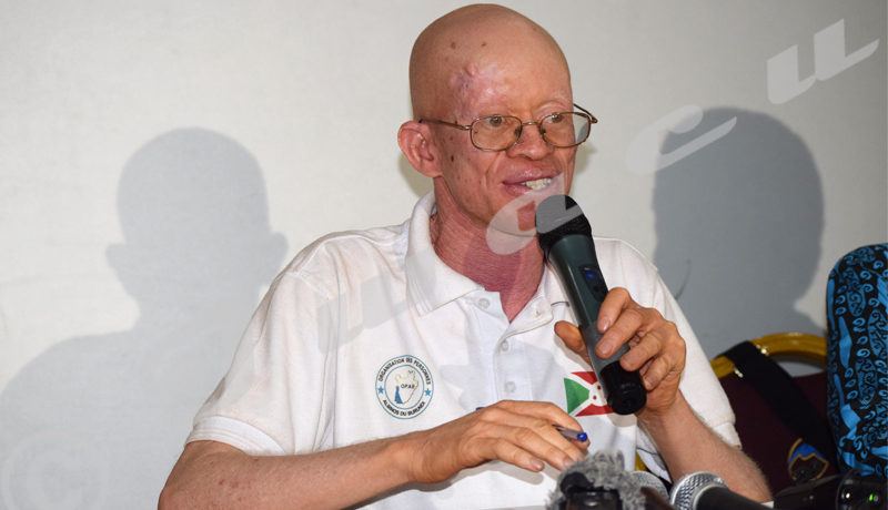 Les albinos burundais face à de multiples défis