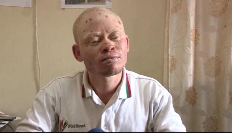 Interview exclusive avec  Chadrack Nahumuremyi :« Abdul Igiraneza est la 28e victime des assassinats ciblés contre les albinos »