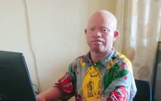Albinisme : deux morts suite au cancer de la peau depuis janvier 2022